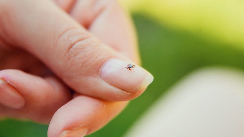 Lice Egg On Finger